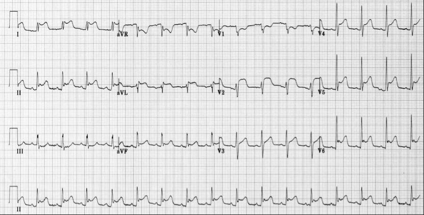 Case Study 39 year old male complaining of sharp, stabbing chest pain with sudden onset at 03:00 hours. The pain woke him from sleep.