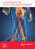 A GUIDEBOOK ON TOTAL JOINT REPLACEMENT